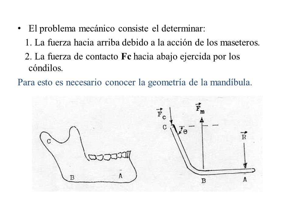 La alta presión de la causa a la osteocondrosis